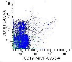 Figure 5: Granulocytes with decreased CD10 expression